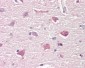 ITPK1 Antibody (aa81-130)